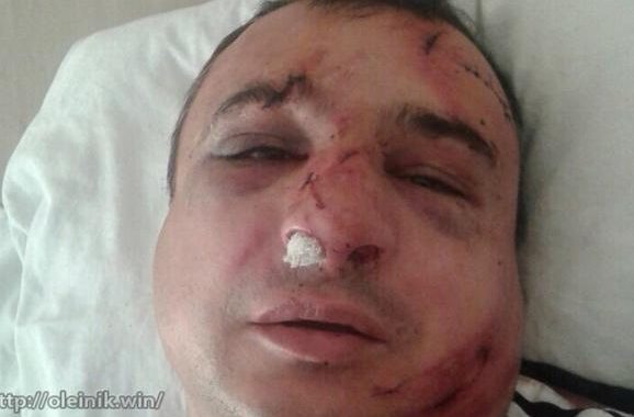 До ГПУ звернувся Арсен Клінчаєв з проханням розслідувати напад на нього До ГПУ звернувся Арсен Клінчаєв з проханням розслідувати напад на нього