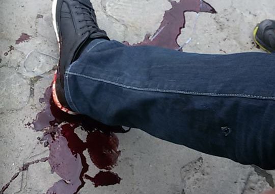 В центрі Ужгорода депутати влаштували стрілянину — версії сторін В центрі Ужгорода депутати влаштували стрілянину — версії сторін