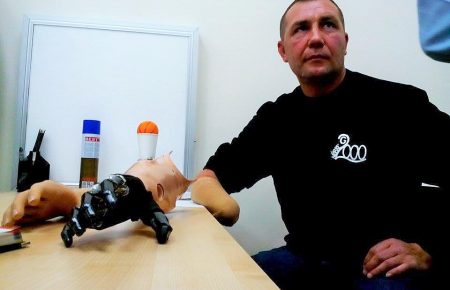 В Одесі вперше встановили біонічний протез, зібраний місцевими протезистами