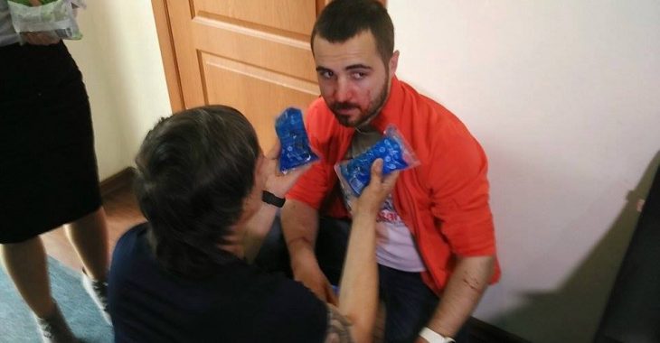 Журналістів одеського «7 каналу» обстріляли з рушниці Журналістів одеського «7 каналу» обстріляли з рушниці