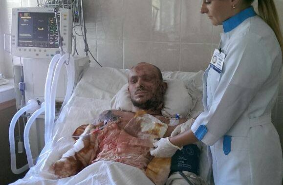 26-річний боєць вижив після вибуху гранати — без руки і з численними ранами 26-річний боєць вижив після вибуху гранати — без руки і з численними ранами