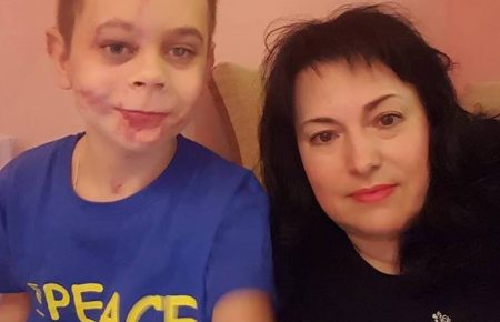 Обещанного три года ждут: Порошенко лично обещал помочь мальчику, потерявшему конечности