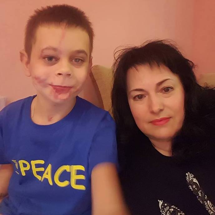Обещанного три года ждут: Порошенко лично обещал помочь мальчику, потерявшему конечности