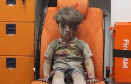 Журналісти з’ясували, як зараз живе сирійський хлопчик, фото якого вразили світ