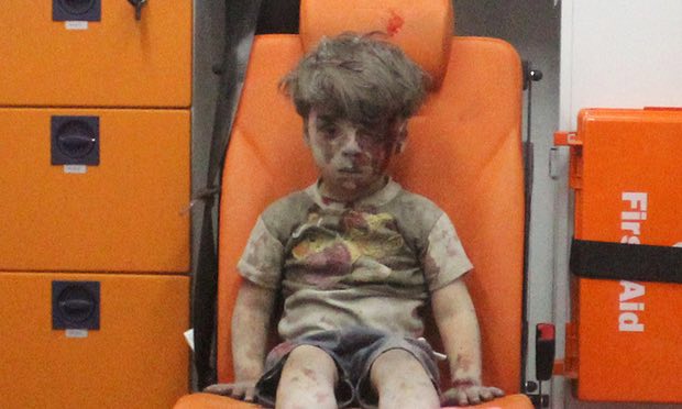 Журналісти з’ясували, як зараз живе сирійський хлопчик, фото якого вразили світ