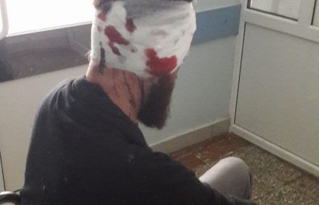 У Харкові побили депутата облради Булаха: зламана щелепа і 3 ребра (ФОТО, ВІДЕО)