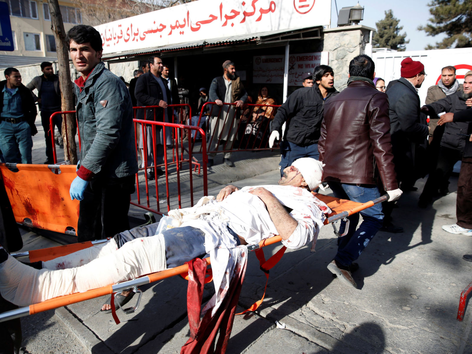 Вибух у Кабулі: кількість загиблих зросла до 103