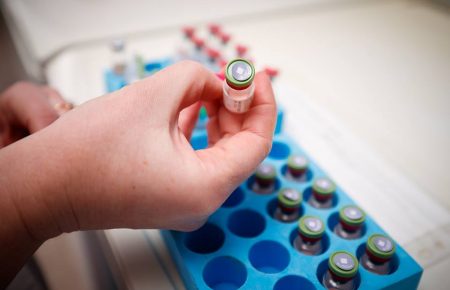 Українська компанія завершила клінічні дослідження імуноглобуліну «Біовен» для лікування коронавірусу