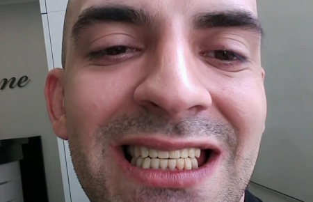Союз стоматологів відновив зуби бійцеві «Азова» Євгену Чуднецову