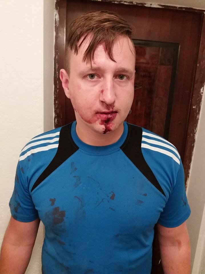 В Одесі пограбували журналіста
