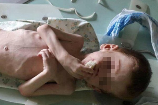Депутат Новоукраїнської райради морив голодом власного 4-річного сина