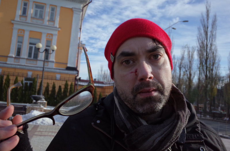 У Києві поліція відкрила кримінальне провадження через напад на канадського журналіста