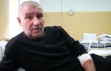 Набрав дров і йшов до хати: поранений житель Чермалика розповів про обстріл (відео)