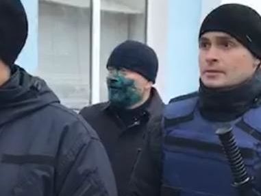 Поліція Бердянська відкрила кримінальне провадження після облиття Вілкула зеленкою