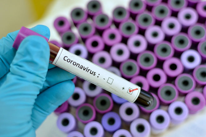 В Україні виявили три випадки підозри на коронавірус — Скалецька