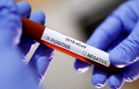 Найбільший ризик заразитися коронавірусом в українців, яким понад 80 років — РНБО