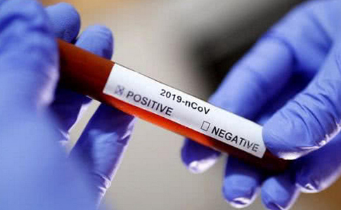 Найбільший ризик заразитися коронавірусом в українців, яким понад 80 років — РНБО
