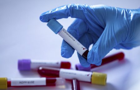 У США почнуть випробовувати ліки від коронавірусу на людях