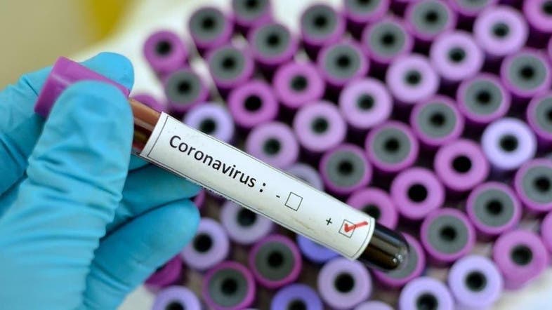 В Египте зафиксировали первый случай заражения коронавирусом