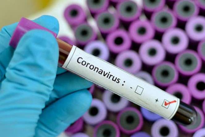 В Україні підтверджено 29 випадків коронавірусу