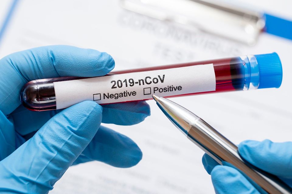 У Житомирській області підтвердили два нових випадки коронавірусу