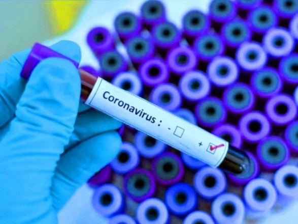 На Черкащині підтвердили другий випадок коронавірусу