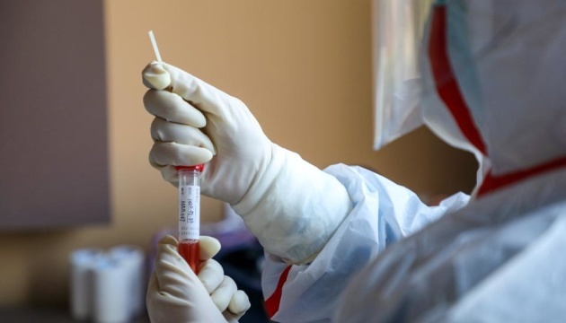 Курпіта: Точність тесту на антиген коронавірусу така ж як при ПЛР-тестуванні