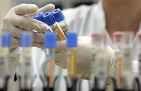 В Україні за добу — 848 нових випадків коронавірусу