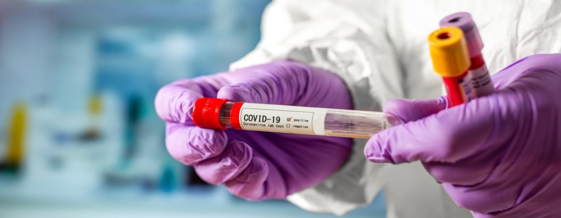Україна має три прототипи вакцин від COVID-19 — Данілов