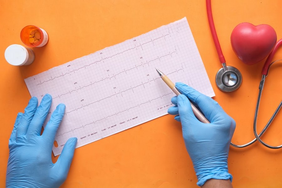 Хвороби серця «помолодшали», інфаркт може статися у 20 років — кардіологиня