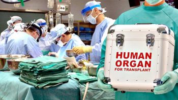 «Разберут на органы» и «ферма доноров»: развенчиваем мифы о трансплантологии в Украине