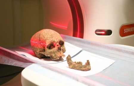 У Тернополі археологи сканували череп, якому три тисячі років (відео)