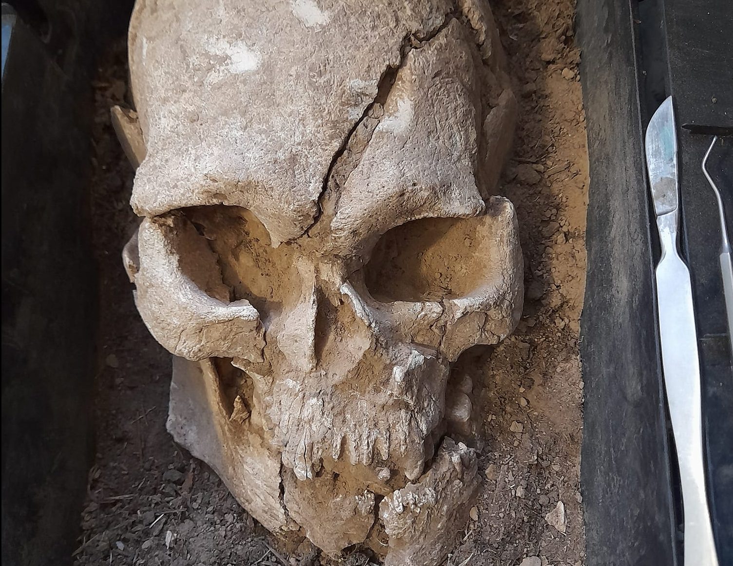 На Мамай-Горі археологи знайшли череп віком 7 тисяч років
