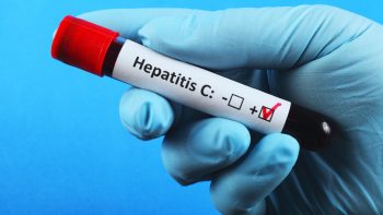 Не вірте людям, які говорять, що можна лікувати гепатит вдома — лікарка-інфекціоністка