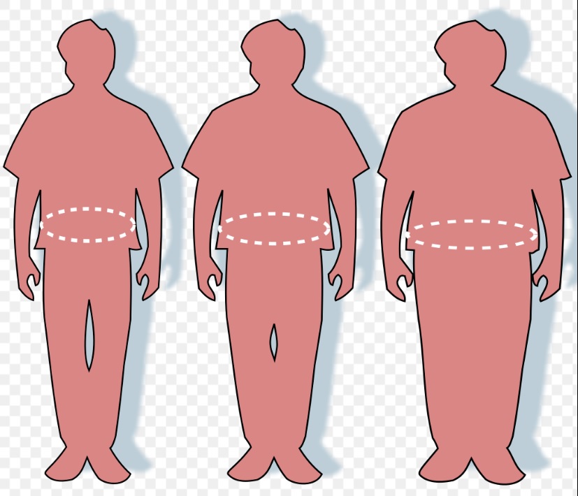 У світі понад мільярд людей з ожирінням — дослідження