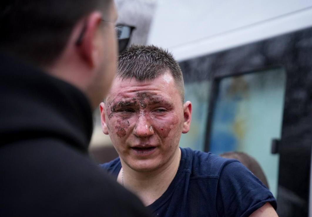 Ракетний удар по Одесі: щонайменше 20 людей поранені (ФОТО)